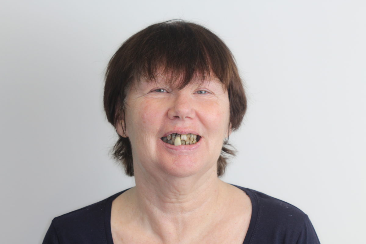 Glenys Before