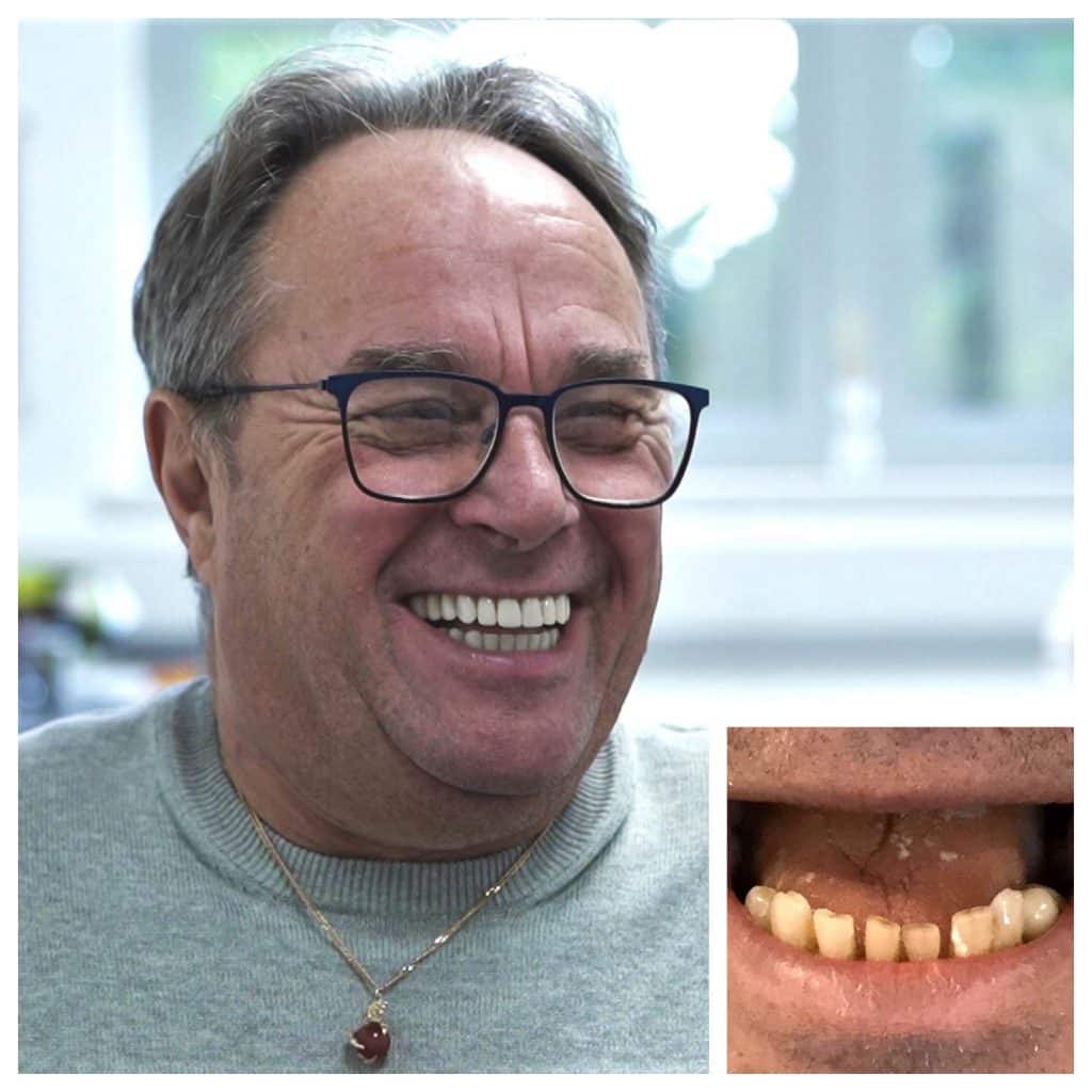 EvoDental The Dental Implant Experts Multiple UK 5* Rated Clinics