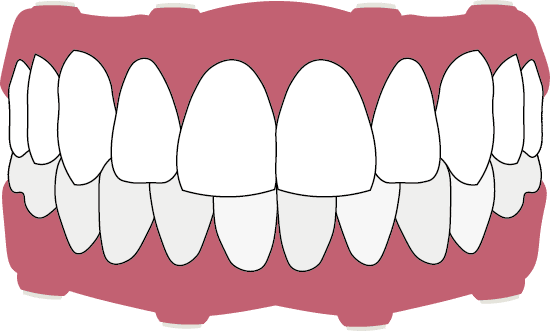 EvoEssentail Full - Evo Dental