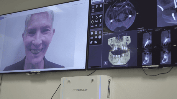 Implants In Bradford - Evo Dental