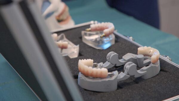 All-on-four dental implant procedure 