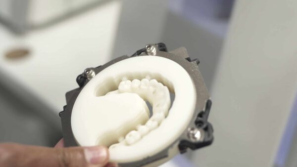 Full Jaw Dental Implants in London