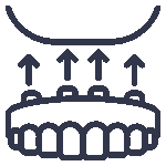 Full mouth dental implants