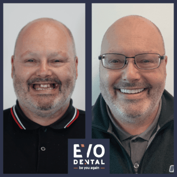 Sutton Coldfield Dental Implants - EvoDental