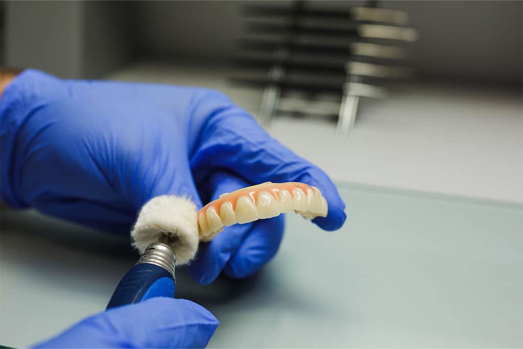 Dental Implants vs Overdentures