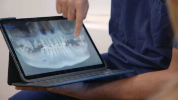 full jaw dental implant dentist working on tablet