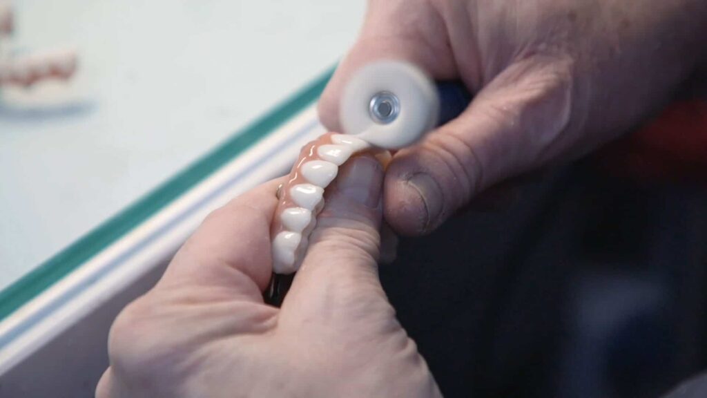Is the cost of dental implants the same everywhere - prosthesis being made