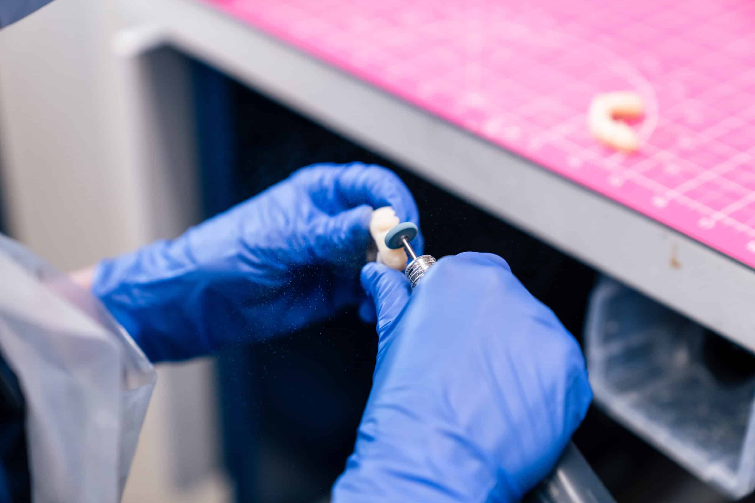 Lab technician working on full-mouth dental implants